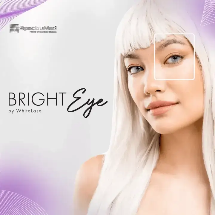 BrightEye Whitelase model showing her glistening eyes