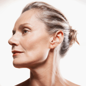 Photo of Model for Harmony Bio-Boost