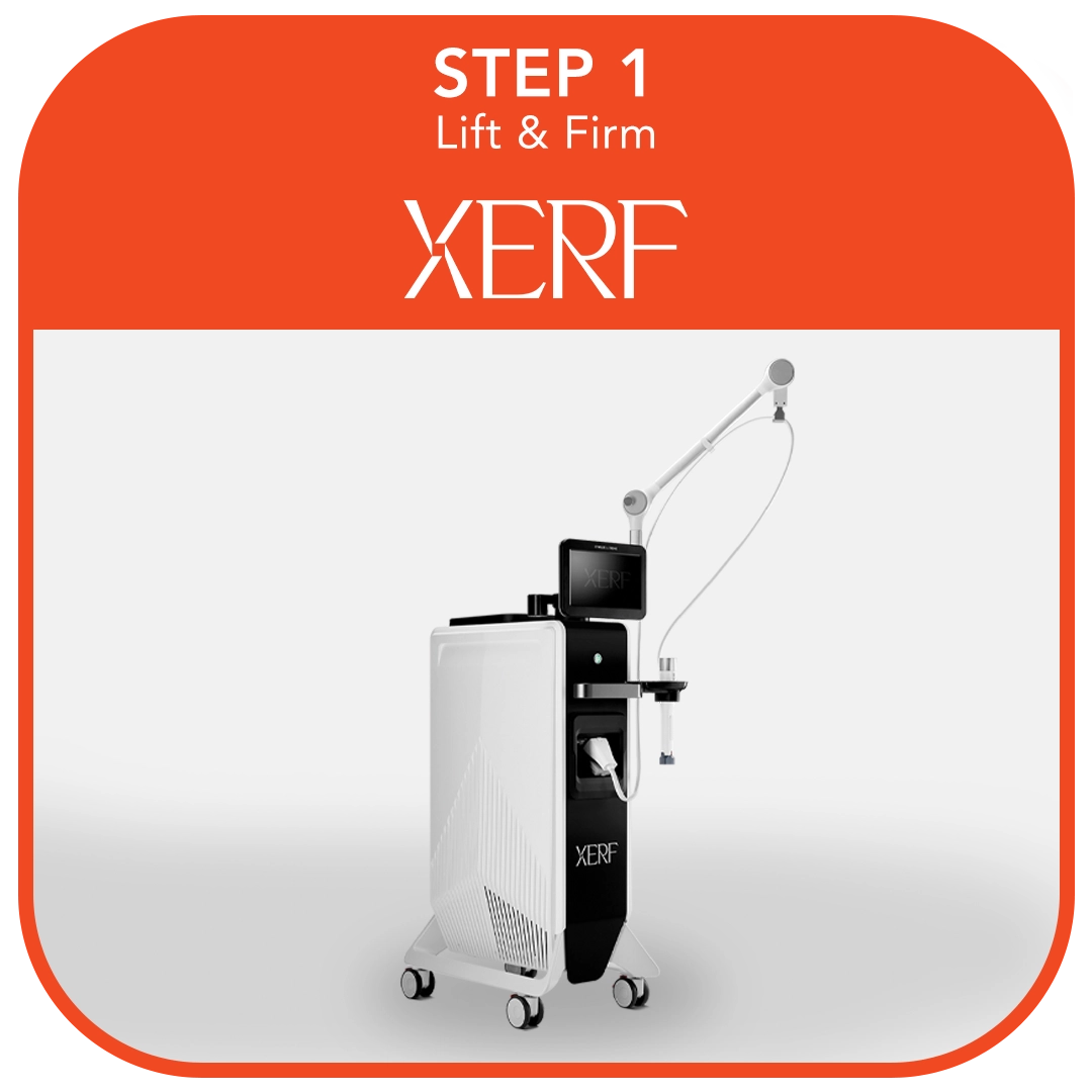 Step 1 XERF