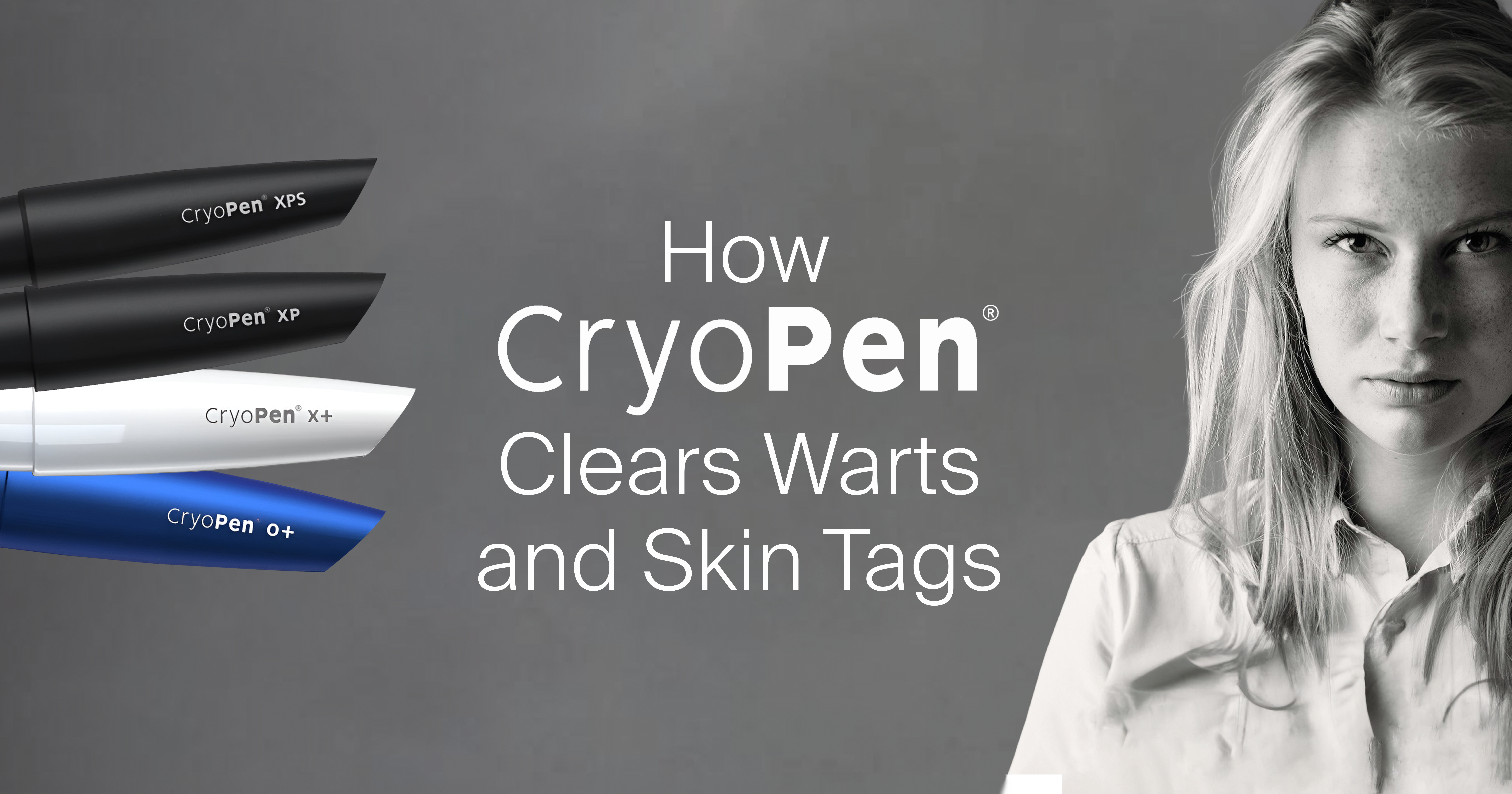 A Touch of Frost, a Clean Slate: How CryoPen Clears Warts and Skin Tags
