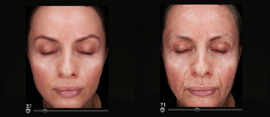 COMPREHENSIVE FACE & SKIN ANALYSIS